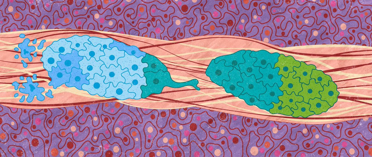 #ICYMI: Beautiful study published online in <a href="/CD_AACR/">Cancer Discovery</a> by  <a href="/KangsanKim_UTSW/">Kangsan Kim</a>, <a href="/MalladiLab/">Malladi Lab - UTSW</a> et al. showing that cell competition can drive metastasis. Now with the art opener 👇👇👇