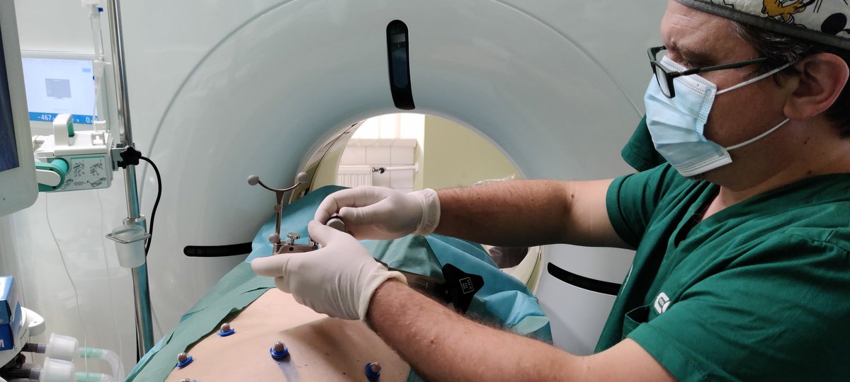 bibokandras's tweet photo. First cases with @CAScination CAS-One (performed by Pál Ákos Deák MD PhD). New level of tumor ablation. #qualityablation #irad #twittIR https://t.co/Jre91KHERT