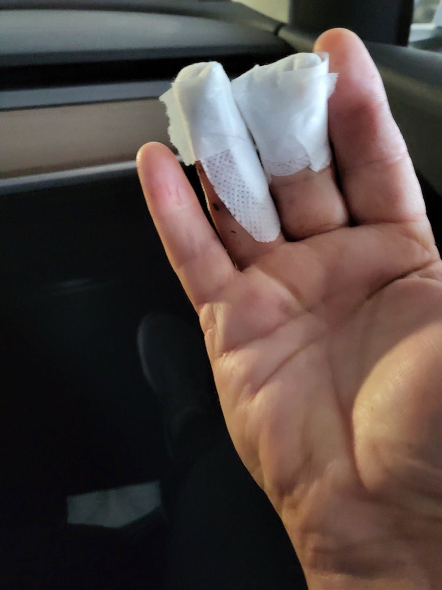 After my little incident yesterday, I'm all fixed up. They amputated middle finger just above the joint. I would like to say what excellent care I got from both Cochrane Urgent Care, and Foothills Medical Center. May be problems in health care but mine was A+