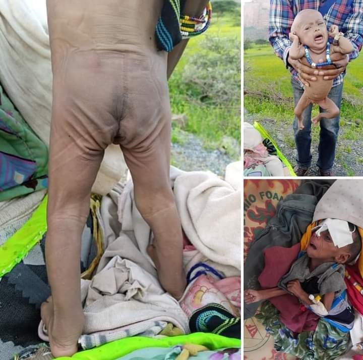 andexgg's tweet photo. The measure of cruelty 😭
This is what #Ethiopia is doing on our people. This is what the #Amhara are doing on us. This is what #Eritrea is doing on our #women &amp; #Children. #TigrayGenoicde is sponsored by @_AfricanUnion @UN @UNGeneva @POTUS @trpresidency @UAE @mfa_russia @china https://t.co/3gRR5TlWK9
