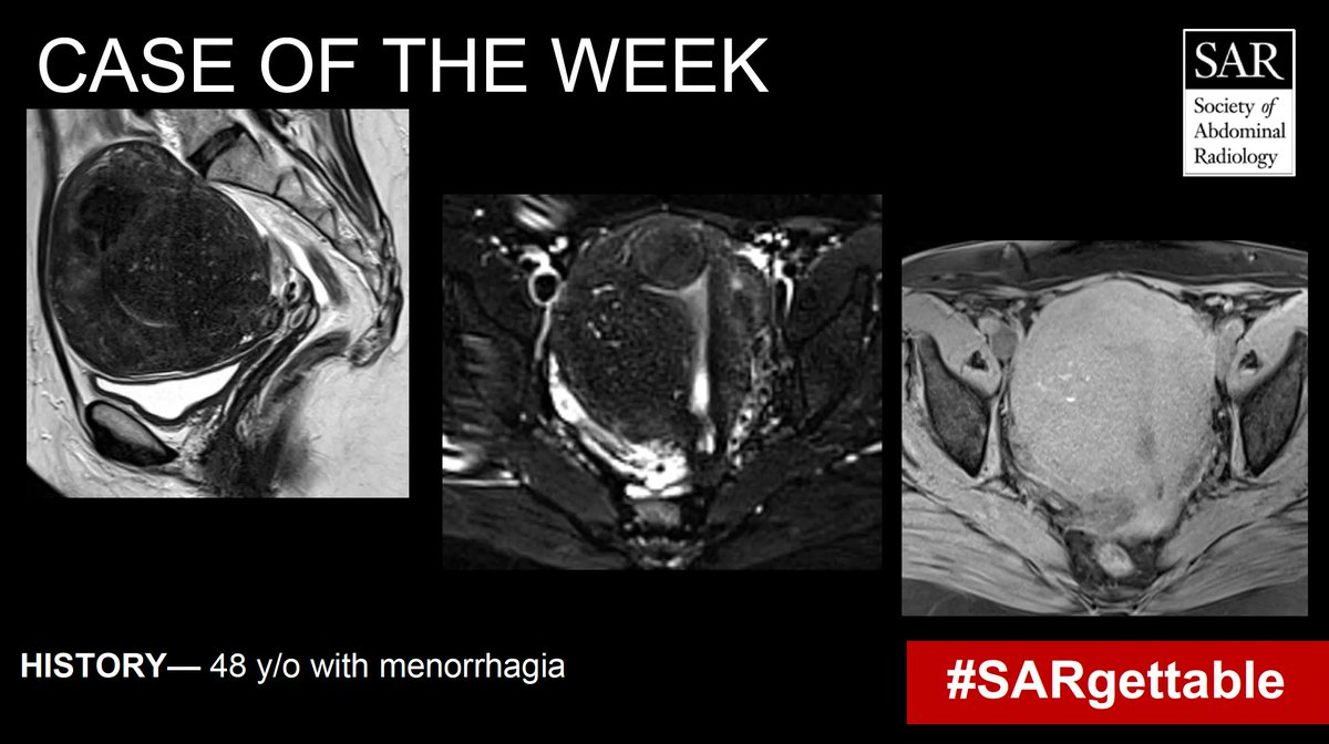 SocietyAbdRad's tweet photo. It's time for a new #SARgettable case of the week! Comment with your diagnosis down below! https://t.co/HOTVyDNw77