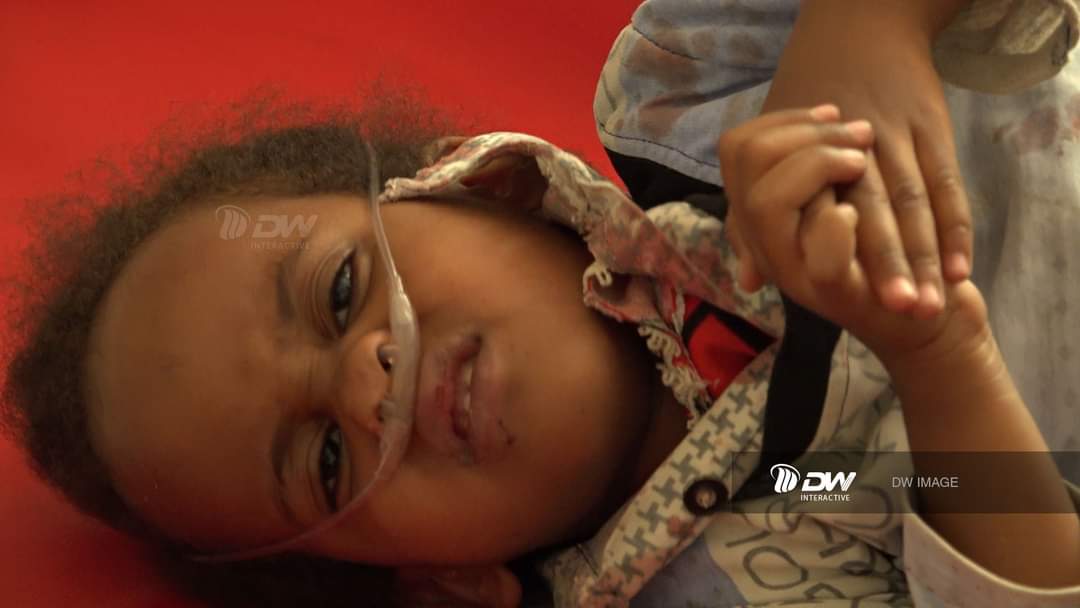 DesiTigray's tweet photo. The Mothers and Children of #Tigray are dying of hunger and lack of medicine
It is known that 600K⁺ people died in #720Days
World leaders must watch and listen to Tigray to prevent further loss of life
#Justice4TigrayWomen
@MikeHammerUSA @EUSR_Weber @WFPChief @SpeakerPelosi https://t.co/NVA5U5YwW8