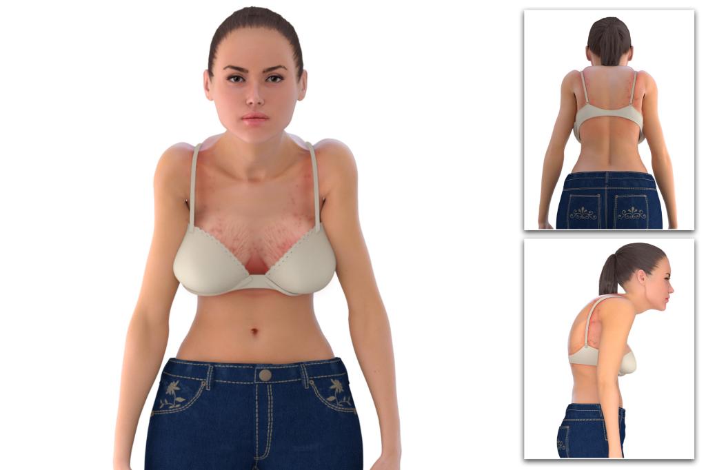 New York Post on X: Wrong bra size can lead to back pain, stretch