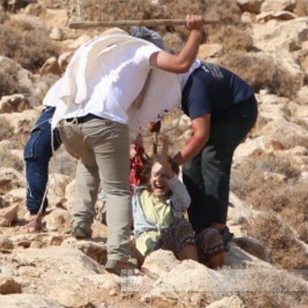 Israeli settlers violently attacked a 70 yr/o Jewish woman who dared to express solidarity with Palestinian farmers. Currently in hospital with broken ribs & punctured lung.