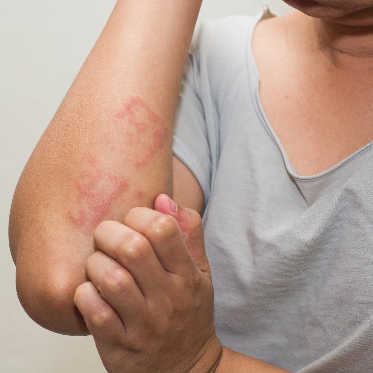 dani_dials's tweet image. It’s very common for adults to suddenly become allergic to shellfish. See blog for more ingredients to avoid: daniellereneebeauty.com/post/adult-she…

#tipoftheday #selfcaretips