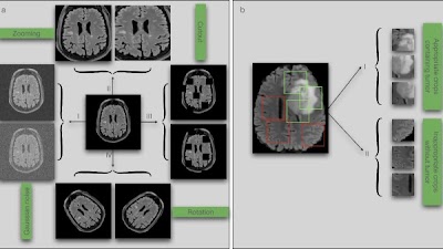 Potential biases during #MachineLearning model development doi.org/10.1148/ryai.2… @KzhangMayo <a href="/Slowvak/">Brad Erickson</a> <a href="/MayoRadiology/">Mayo Clinic Radiology</a> #bias #AI #ML