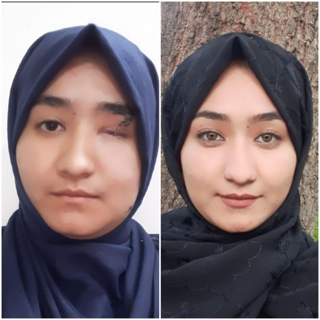 فاطمه امروز در امتحان کانکور شرکت کرد برای کامیابی و شفایاب شدن فاطمه! #StopHazaraGenocide