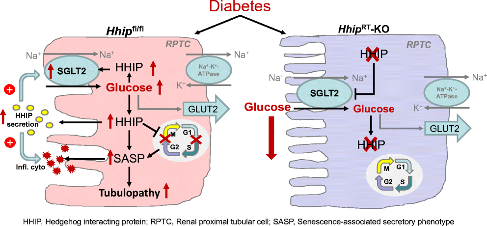 #HHIP activates #SGLT2 expression and promotes renal tubular epithelial cell senescence in mice with type 1 diabetes #T1D @CRCHUM @BiblioCHUM @chumontreal @med_umontreal @Umontreal @shaolingzhang1 #MedTwitter