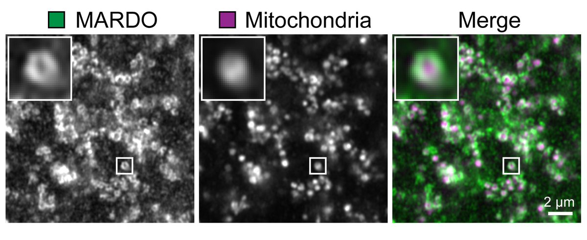 Oocytes rely on maternal mRNAs for development into healthy eggs. But where and how are these mRNAs stored? Our latest work in @ScienceMagazine shows that mammalian oocytes store mRNAs in a mitochondria-associated membraneless compartment (MARDO). bit.ly/3MNQSf1 (1/9)
