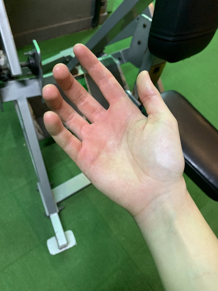 Wendyreap's tweet photo. Okay.  I definitely need to buy some exercise gloves. 🫠 https://t.co/8B5jNDKf4D