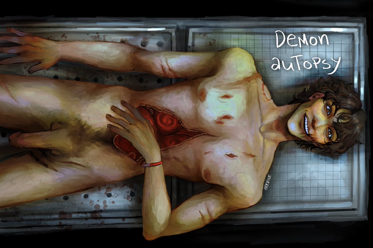 ark_bile's tweet photo. Toby’s Dissection #ticcitoby #creepypasta #tobyroger #gore https://t.co/OTDxTD8ma8