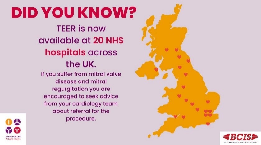 UkValve's tweet photo. 20 NHS centres across the UK provide life-changing #TEER.

If you suffer from #mitralvalvedisease and #mitralregurgitation you are encouraged to seek advice from your cardiology team about referral for the procedure. 

Check out the map for more info: https://t.co/m32y1CcPdC https://t.co/1r7FneldYT