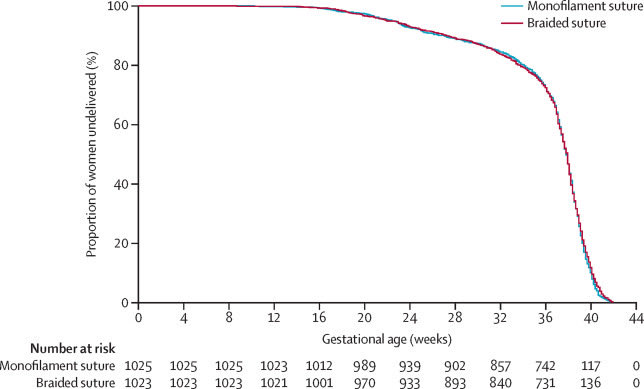 OBSevidence's tweet photo. Cstitch in Lancet today. Monofilament suture did not reduce rate of pregnancy loss when compared with a braided suture (8 vs 7.6%). Monofilament sutures harder to remove (31.2vs 14.6%.) Less chorioamnionitis ? but not sepsis or pyrexia. ?Use what you like. https://t.co/Dgil4gZI0v https://t.co/9qkYhV43S1