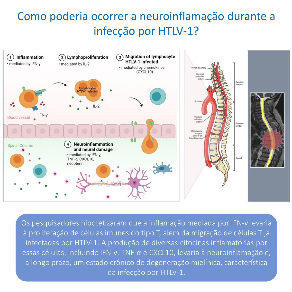 Rimtsp's tweet photo. A Revista do IMTSP publicou um trabalho mostrando o papel de citocinas inflamatórias no curso de doenças infecciosas crônicas e como isso pode estar associado ao dano neuronal. Clique e confira: https://t.co/uu3DhJ82nE https://t.co/e2adtU5DB3