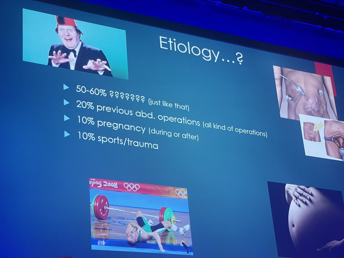 Herniadoc's tweet photo. The god of #ACNES speaks @EhsManchester ! Dr Rudi Roumen.
👉🏻More in females
👉🏻Often right sided. 1/10 will have bilateral symmetric pain
👉🏻Many times in my children 
👉🏻pinch test, also use cotton tip, Carnett +, no imaging https://t.co/sMBmuDpUYR