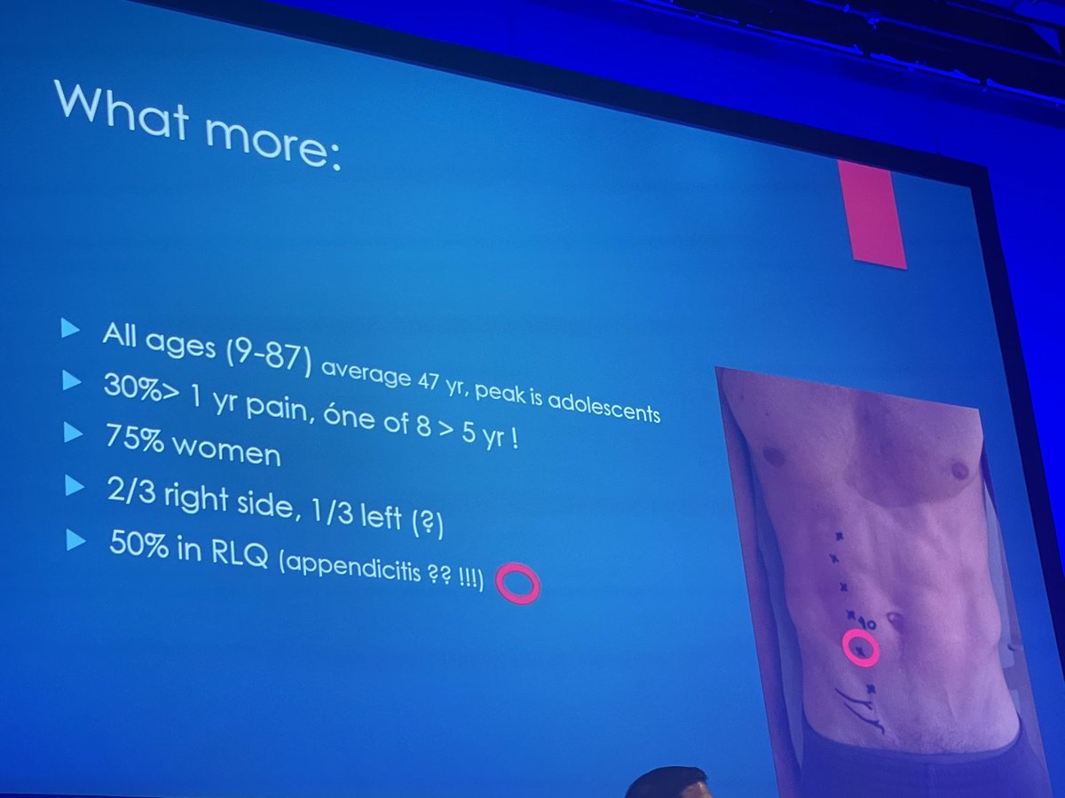 Herniadoc's tweet photo. The god of #ACNES speaks @EhsManchester ! Dr Rudi Roumen.
👉🏻More in females
👉🏻Often right sided. 1/10 will have bilateral symmetric pain
👉🏻Many times in my children 
👉🏻pinch test, also use cotton tip, Carnett +, no imaging https://t.co/sMBmuDpUYR