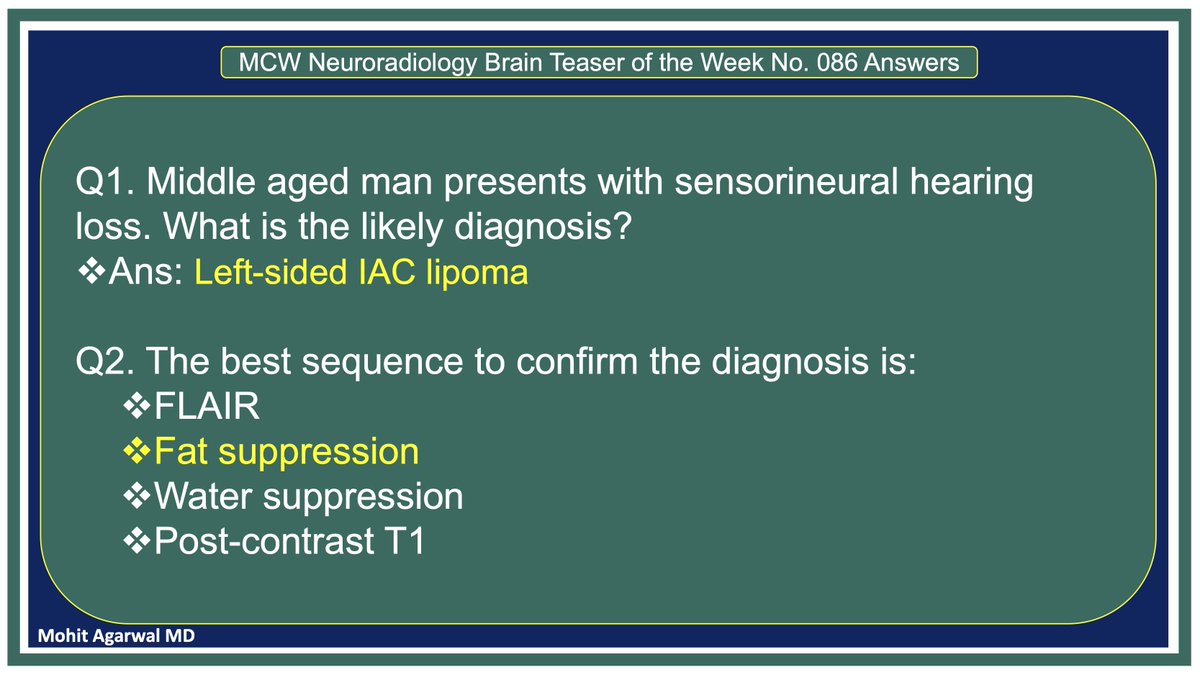 MohitAgNeurorad tweet picture