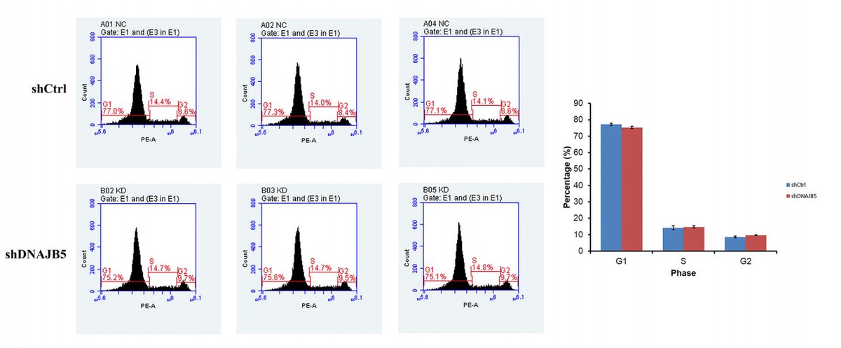EJGO_1980's tweet photo. 🎉🎉Welcome to read the new publication in the #EJGO
DNAJB5 (hsc40) gene as a novel biomarker for cervical cancer
For more detail: https://t.co/LahZyVqe7q
#DNAJB5 #Cervical_cancer #shRNA #HSP https://t.co/2xshNL81Ap