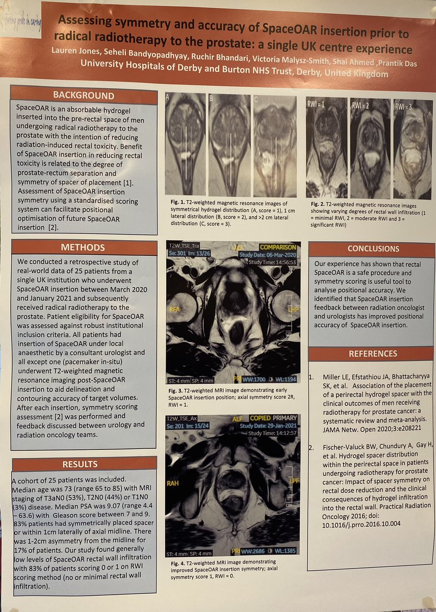 It’s great to be together for our 🇬🇧 & 🇮🇪 SpaceOAR Expert User Meeting. Great discussions from across the network 👏🏼 #ImprovingPatientOutcomes #SABRE