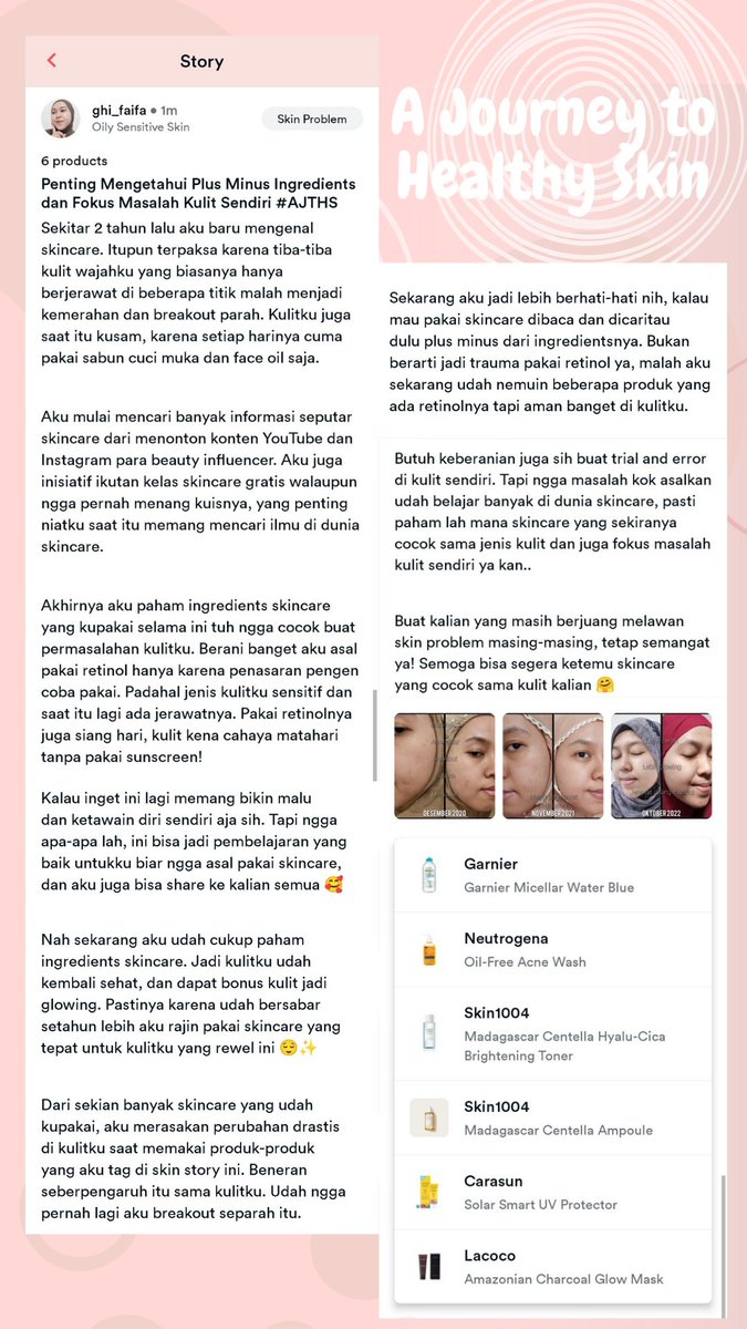 ghi_faifa's tweet photo. Pengalamanku ini aku share di @debaede jadi daripada tulisannya kecil banget susah bacanya, mending kalian ikut donlot apps Debaede dan ikutan share #AJTHS kalian juga gaes 💗 #skincareroutine #pejuangjerawat #breakout #skinproblem #healthyskin https://t.co/6ZKaYzGDIb