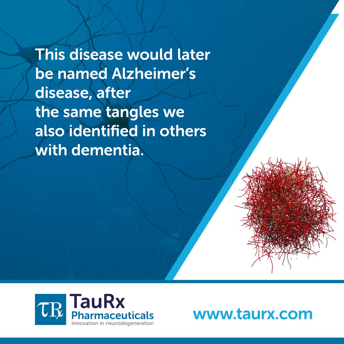TauRx's tweet photo. ❓How much do you know about the origin of Alzheimer’s Disease?
Find out about the first observation of tau tangles below ⬇️
Learn more about how this relates to the work we do at https://t.co/M4QGggabmh
#TauFact #TheTimeForTauIsNow #Dementia #Alzheimers https://t.co/u5YDC7dBU0