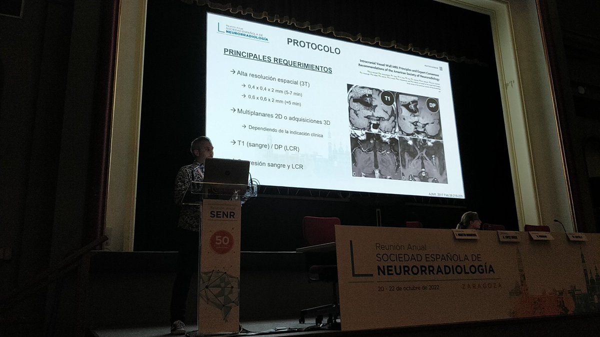 VictorSuarez_Rx's tweet photo. @AntonioLR81 hablando de un tema de moda. Vessel wall imaging. #RM #3Tesla que a los nos intervencionistas nos viene de maravilla. https://t.co/kKzdty8f0T