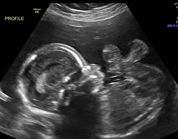 jcompton83's tweet photo. New artwork for sale! - "Hello My Baby" - https://t.co/ruxfGhrSE5 @fineartamerica https://t.co/YVUx5NVQ25