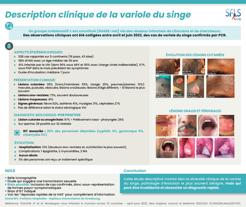sfls_vih's tweet image. Repères biblio @sfls_vih : Description clinique de la variole du singe 
👉🏻 Diversité clinique
👉🏽 Evolution le plus souvent bénigne mais qui peut être douloureuse et invalidante 
👉🏻 Diagnostiquer et prendre en charge : has-sante.fr/jcms/p_3361191…

sfls.fr/bibliographie/
#biblioSFLS