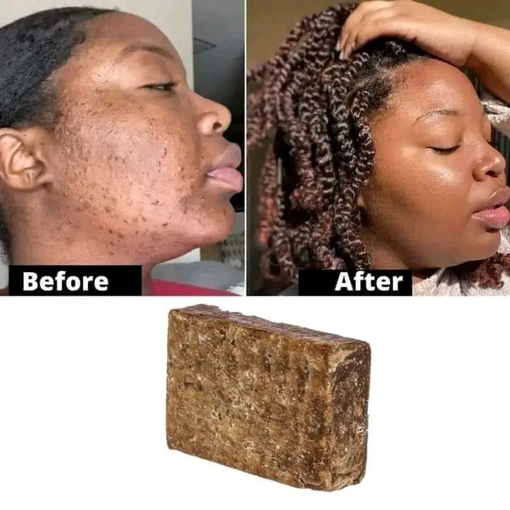 SBootelazy's tweet photo. *W.P.S Organics We are wholesalers and retailers of

•Skin products

•Molato soap and cream 
•Raw shea butter 
•Carrot oil
•Papaya oil
•African black soap
•Turmeric soap and cream
•Skin repair oil and butter
•Whitening soap, serum and cream 
https://t.co/gBCWuv2CaY https://t.co/UHVEsQpQed