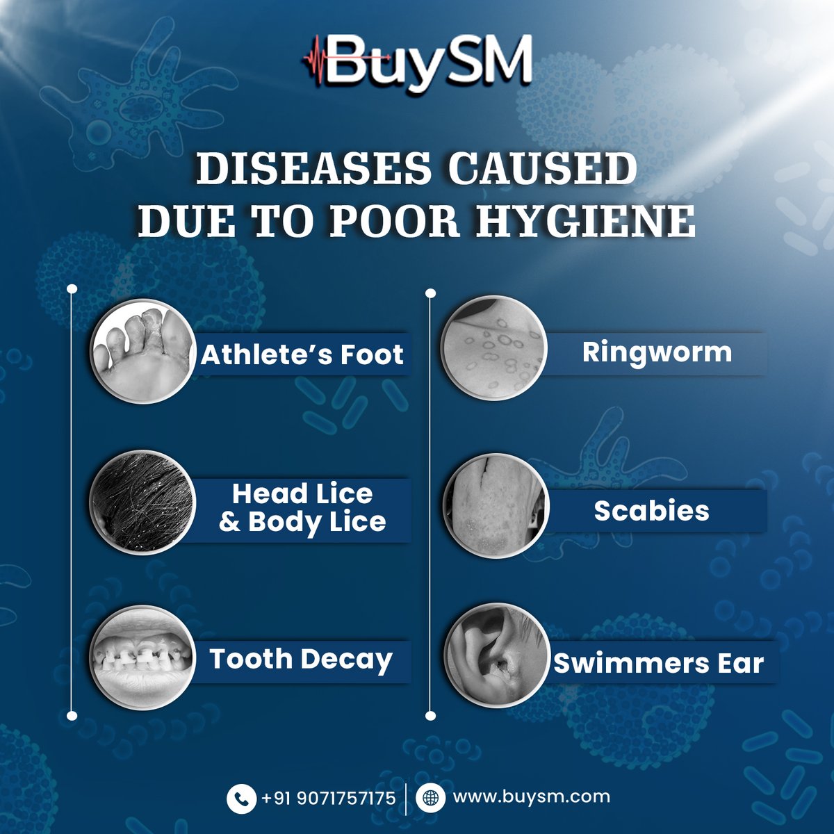 buysmofficials's tweet photo. Poor hygiene is linked to transmission &amp; spread of diseases. It reduces human well-being, social &amp; economic development. Good hygiene leads to good health.
Visit on: https://t.co/WOVBmmM5uT
#buysm #hygiene #healthylifestyle #specialitypharma #healthcare #superspecialitymedicines https://t.co/fcNPuJNqtD