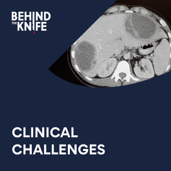 Don't miss 2 high-yield Clinical Challenge episodes we released this week. This is quality stuff folks! IPMN: behindtheknife.org/podcast/clinic… @lexyadams16 @connor_chick @vreelant @usarmydoc24 Mesenteric Ischemia: behindtheknife.org/podcast/clinic… @CraigBrownMD @FrankMDavisMD @bobby_beaulieu