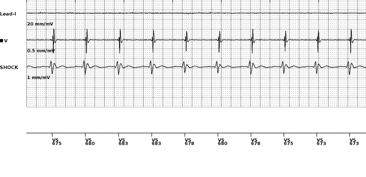 Gregory Michaud tweet media