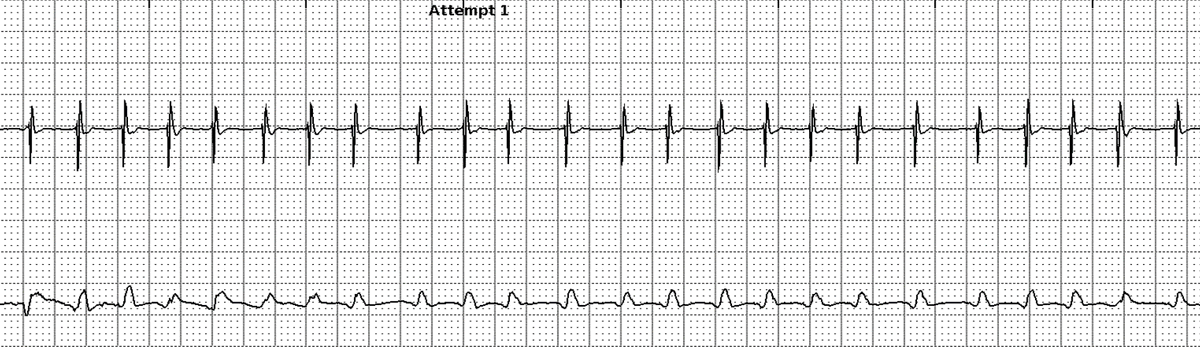 Gregory Michaud tweet media