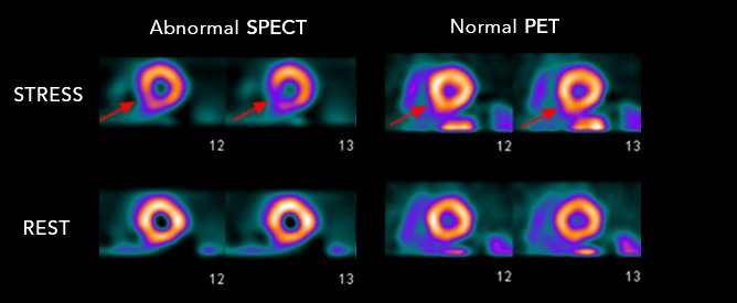 VLSorrellImages's tweet photo. #JADIL
Our Advanced Cardiac Imaging ACI program took another major step forward yesterday as we launched our Cardiac PET program. Another phenomenal collaboration between CV & Radiology.
@GillKentucky @Kentucky_Cards @UK_HealthCare https://t.co/p6YSp8QzsF