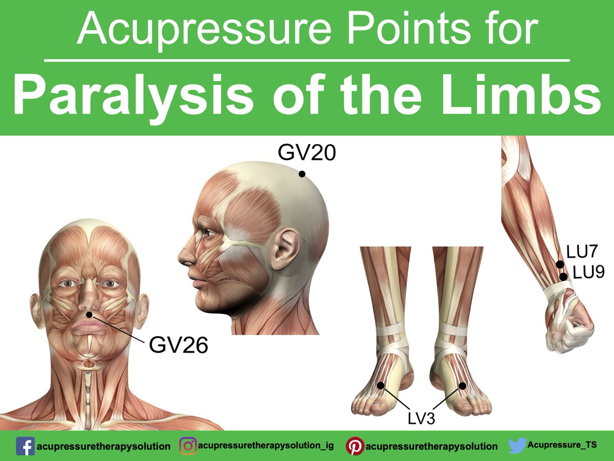 Acupressure_TS's tweet image. Acupressure Points for Paralysis of the Limbs

If you have symptoms “Paralysis of the Limbs” try using this point to treatment.

&amp;gt;&amp;gt;&amp;gt; Click here to Get "The Ultimate Acupressure Quickstart Guide!"

Bit.ly/FreeBook365

#paralysisofthelimbs #paralysisproblems #acupressure #tcm