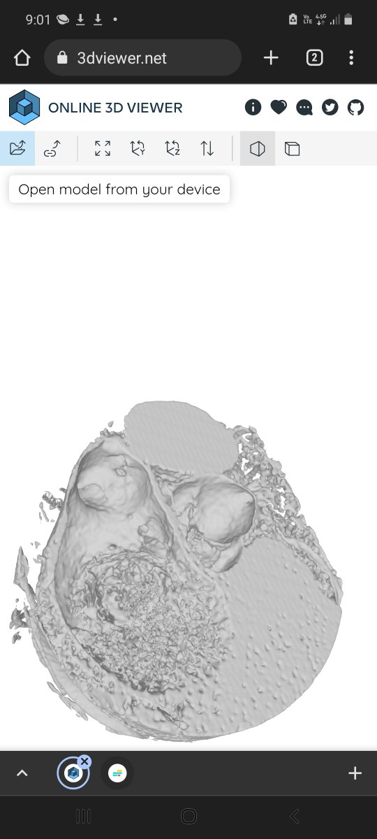 JoseRos92735274's tweet photo. @Online3DViewer thank you
MITRAL PARA VALVULAR LEAK 
for Cardiac Tomography https://t.co/1gkhW7OS7Y