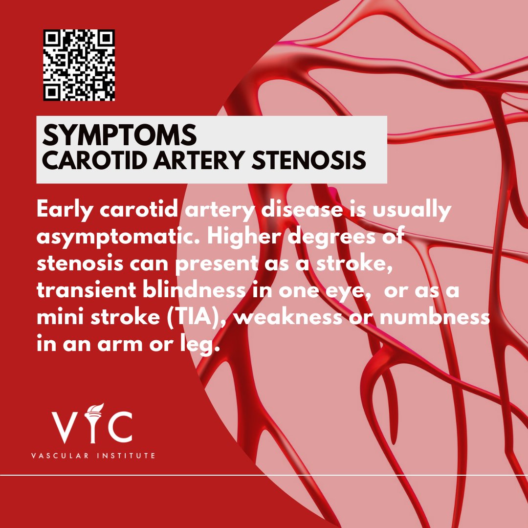Knowing what to watch out for is critical with CAS.
#VICOctober #VIC #VICVascular #Veins #Endovascular #ArteryDisease #FLOW #VascularSurgery #VaricoseVeins #PAD #CAS #RAS #Aneurysm #Arterial #CLI #CLIFighter #Carotid #Peripheral #Renal #Atherosclerosis #Plaque #Stroke