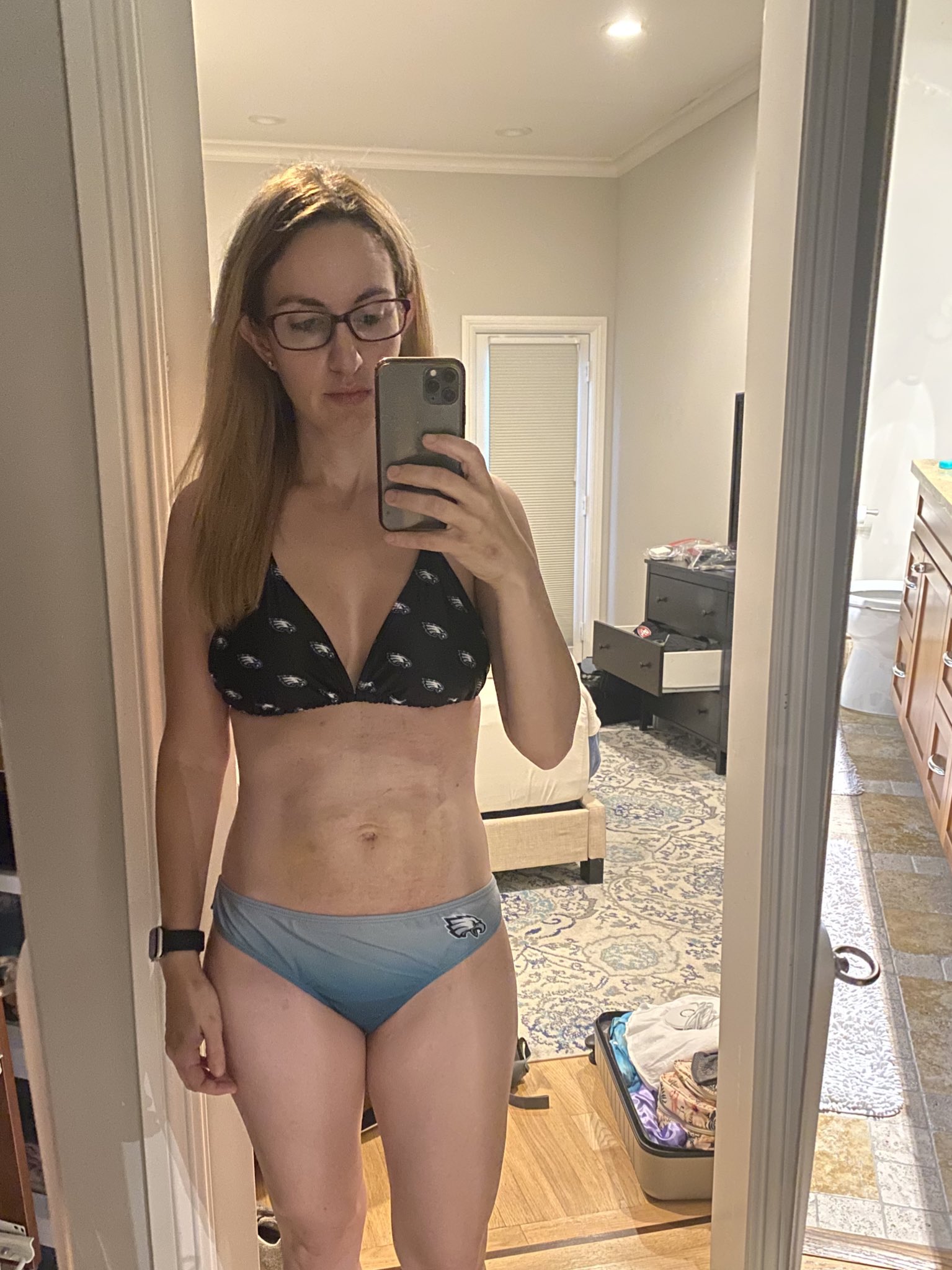 Sara Mauskopf on X: Smaller boobs thirst trap for a very niche audience  (ignore bruises on stomach, will heal) #FlyEaglesFly   / X