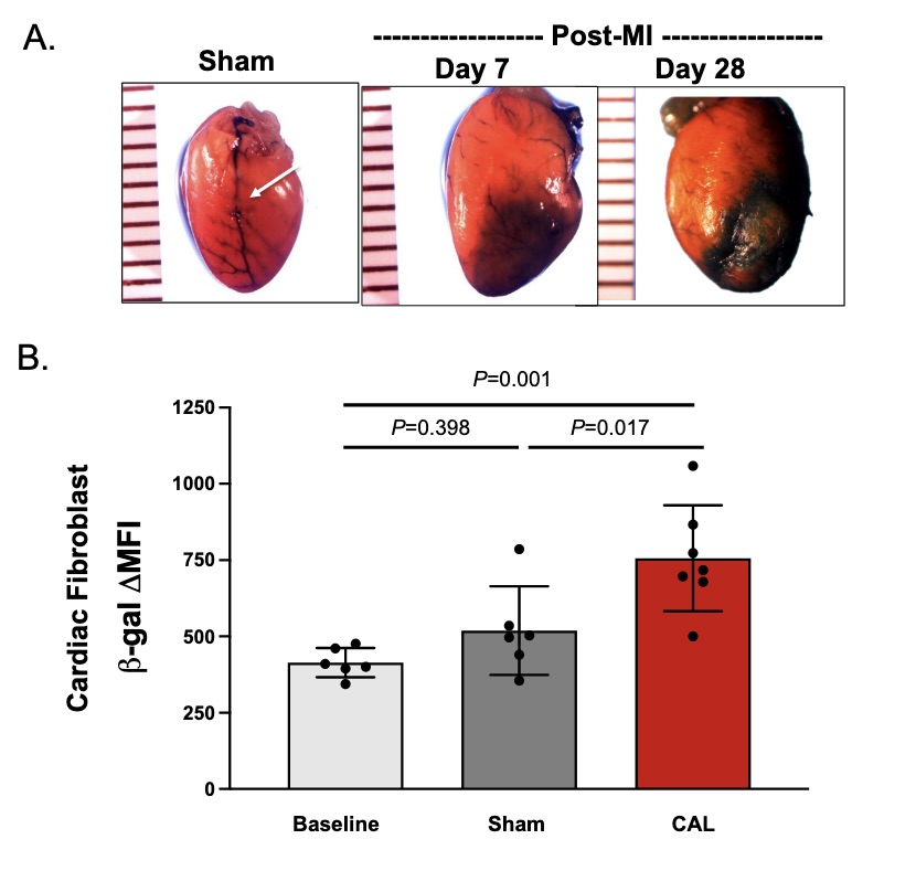 ajpheartcirc's tweet photo. #ArticlesInPress: Ectonucleoside #triphosphate diphosphohydrolase-1 (CD39) impacts TGF-β1 responses: Insights into cardiac fibrosis and function following #myocardial infarction
(Novitskaya, et al.)
https://t.co/hdFTsWTnDe
@Gumina_Lab @SSBansal_OSU @NishatShamama
#fibrosis #CD39 https://t.co/jFP7L58xbo