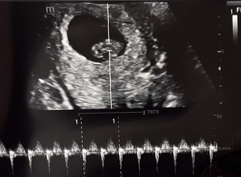 seoulstylist's tweet photo. From #Amma to #Halmoni we’re expecting an addition to the family…Baby Johnson ~ May 2023💛 https://t.co/QQIMmMsZ7B