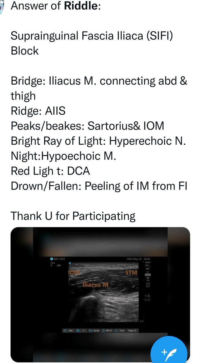 KartikBSonawane's tweet photo. @jeffgadsden @ASRA_Society @ESRA_Society @AoraIndia @LasraAnestesia @James_Kim_MD @KalagaraHari @Steve_Coppens @ajrmacfarlane @amit_pawa @EMARIANOMD @dr_tgro @dr_rajgupta #RARiddles 

My Riddle on SIFI Block https://t.co/PWX2nWltVH