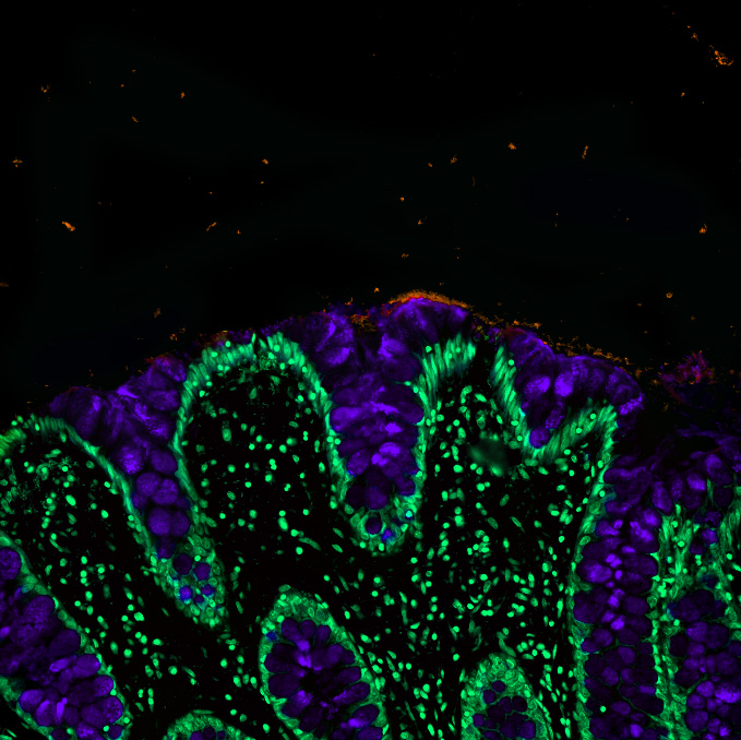 micromindy's tweet photo. Enjoying #FluorescenceFriday with a little #colon #mucus and #microbes in festive #Halloween colors! #bioart #sciart #underthemicroscope #MicrobeMayhem #gobletcell #FluorescentFriday #Mucusmatters #SpookyTober #Microscreepy https://t.co/woyzCvN61E
