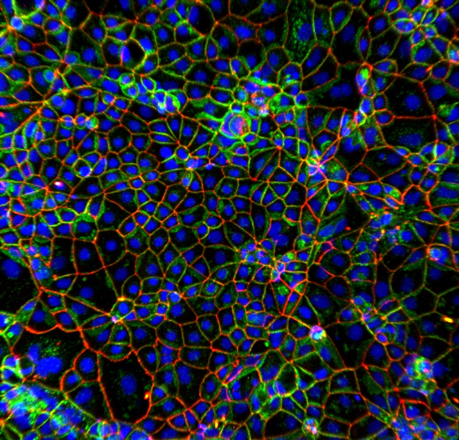 Caco-2 cells stained for E-cad (green) ZO-1 (red) and DAPI (blue) #FluorescenceFriday #organoids #humanintestinalorganoids #microscopy #cellbiology #sciart #bioart