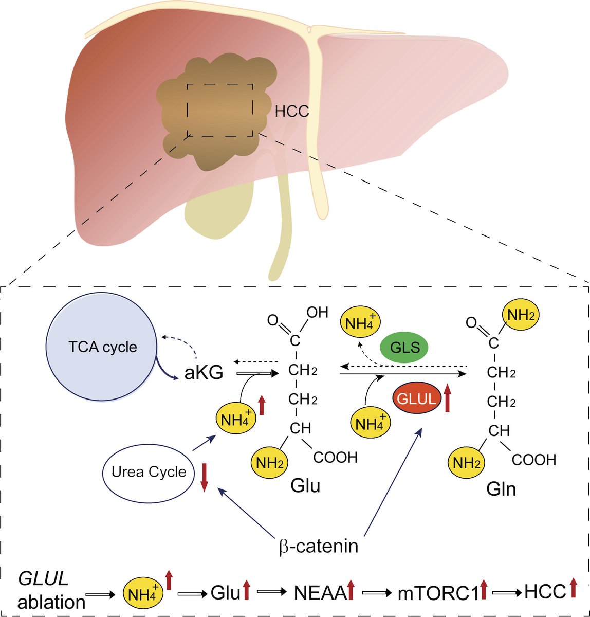 Hepatic Cell News (@hepaticcellnews) on Twitter photo A team led by Drs. <a href="/WeiweiDai/">Weiwei Dai</a> and Jianliang Shen studied #livercancer growth, finding that #beta-catenin induced the expression of glutamine synthetase (GS), but genetic ablation of hepatic GS accelerated the onset of liver tumors.
📖: <a href="/jclinicalinvest/">Journal of Clinical Investigation</a>
bit.ly/3N70iCB A team led by Drs. <a href="/WeiweiDai/">Weiwei Dai</a> and Jianliang Shen studied #livercancer growth, finding that #beta-catenin induced the expression of glutamine synthetase (GS), but genetic ablation of hepatic GS accelerated the onset of liver tumors.
📖: <a href="/jclinicalinvest/">Journal of Clinical Investigation</a>
bit.ly/3N70iCB