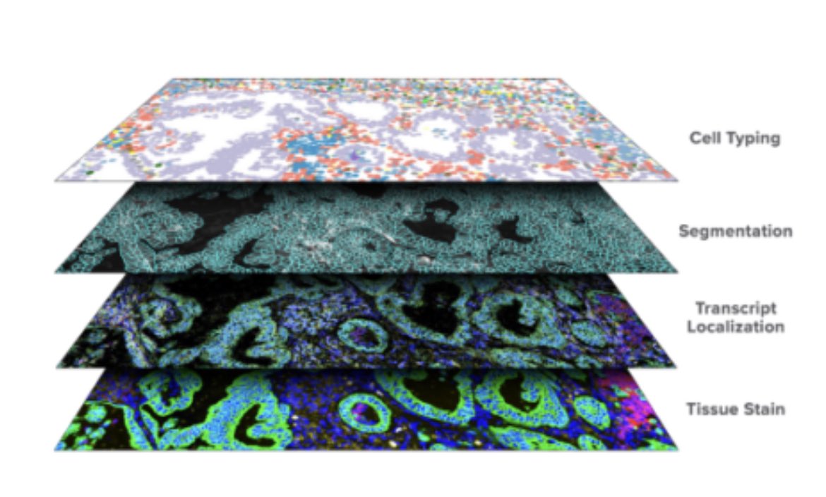 Nigel B. Jamieson (@nigeljamieson) on Twitter photo Thanks to <a href="/The_MRC/">Medical Research Council</a> for supporting our #cosmx @nanostringtech application
Well done everyone <a href="/LabSpatialNBJ/">Jamieson Spatial Lab</a>
<a href="/UofGCancerSci/">UofG Cancer Sciences</a>
We are excited about #spatialbiology projects that this will unlock across <a href="/UofGMVLS/">UofG MVLS</a> <a href="/CRUKScotland/">Cancer Research UK in Scotland</a> <a href="/grisurgery/">Surgery Glasgow Royal Infirmary</a>
#everysinglecell #PancreaticCancer Thanks to <a href="/The_MRC/">Medical Research Council</a> for supporting our #cosmx @nanostringtech application
Well done everyone <a href="/LabSpatialNBJ/">Jamieson Spatial Lab</a>
<a href="/UofGCancerSci/">UofG Cancer Sciences</a>
We are excited about #spatialbiology projects that this will unlock across <a href="/UofGMVLS/">UofG MVLS</a> <a href="/CRUKScotland/">Cancer Research UK in Scotland</a> <a href="/grisurgery/">Surgery Glasgow Royal Infirmary</a>
#everysinglecell #PancreaticCancer