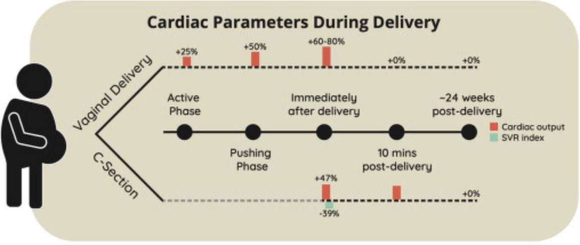 A great review of #CardiogenicShock in Pregnancy by @NatalieTapaskar @KiranKhush1 and team @JCardFail @Womenintxp_mcs 👏 👉 bit.ly/3MQjAMa