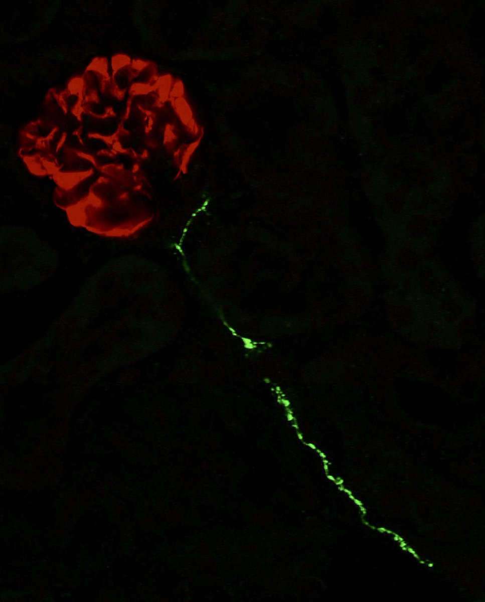 l_obrien_lab's tweet photo. Our fantastic rotation student Gabby took this image and perfect timing for #FluorescenceFriday. Kidney glomerulus in red, CGRP+ nerve in green. Will leave this one in red and green since it seems fitting for this kidney ‘rose’. https://t.co/83Bx8a1mNo