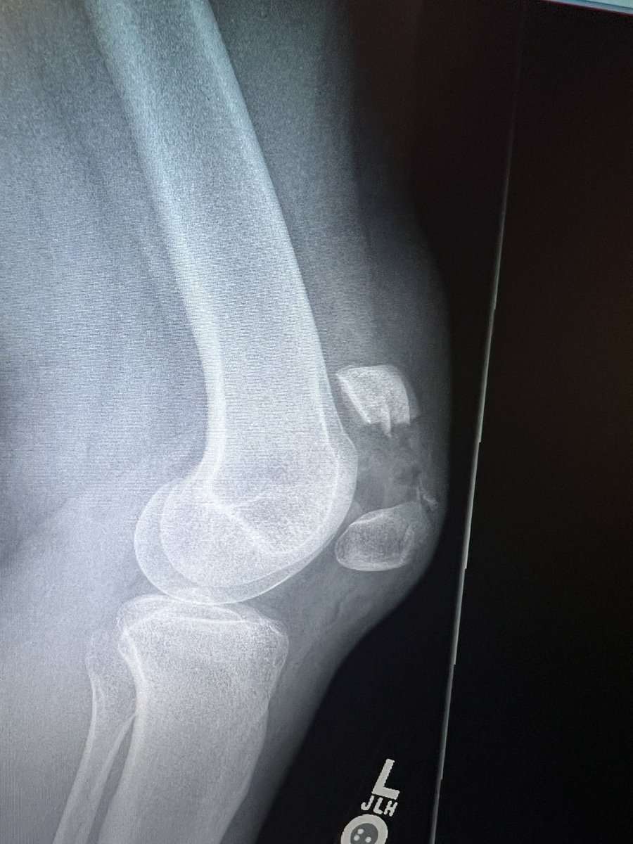 Society of Military Orthopaedic Surgeons tweet media