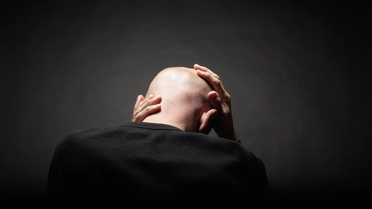 Más cerca del fin de la calvicie. Un estudio de la Universidad Yokohama, Japón, demostró que se pueden fabricar folículos pilosos de ratón. Ya no sería necesario extirpar el cabello de una zona para reimplantarlo en otra y solo bastará con hacerlo crecer in vitro. Los detalles