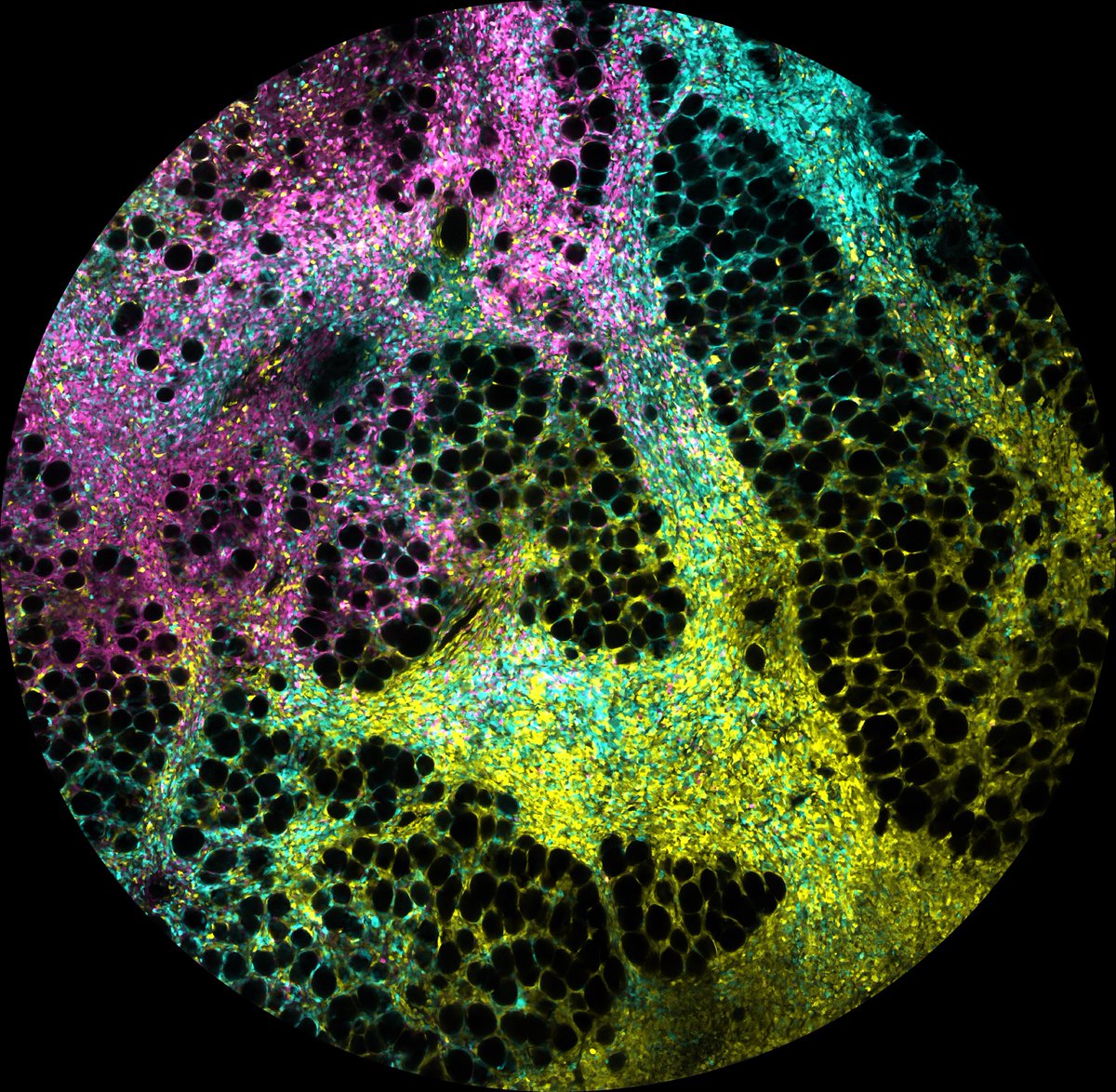 Honoured to have received 3rd place in this year’s @WEHI_research Art of Science still image category, judged by the incredible @corey_tutt. Special thanks to our collaborator at @ONJCRI Dr Jean Berthelet for his contributions to this work.